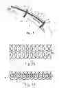 Fig. 02 - Drapes with circumferential and longitudinal breakaways