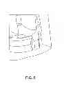 Fig. 09 - Male medical implement cleaning device