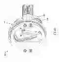 Fig. 13 - Check valve in backflow prevention device
