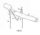 Fig. 04 - Aerospace sand casting support