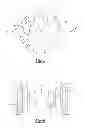 Fig. 04 - Bimetallic casting