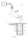 Fig. 02 - Fast pressure protection system and method