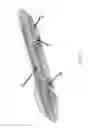 Fig. 02 - Suppressing a fire condition in an aircraft