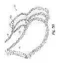 Fig. 09 - Stalk Folding and Breaking Device