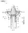 Fig. 04 - Water stop structure for wire harness and wire harness