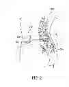 Fig. 03 - Insulator for a feedthrough