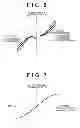 Fig. 06 - TWO-PHASE MOTOR AND HYDRAULIC POWER STEERING SYSTEM USING THE TWO-PHASE MOTOR