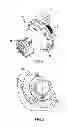 Fig. 02 - ARRANGEMENT FOR A CAPTURE DEVICE INTENDED TO BE USED IN SURROUNDING IN WHICH THERE IS A RISK OF EXPLOSION
