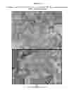 Fig. 09 - Topical glycopyrrolate formulations