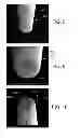 Fig. 07 - Microfluidics delivery systems