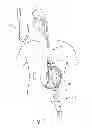 Fig. 09 - Trans-oral circular anvil introduction system with dilation feature