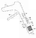 Fig. 01 - Device and Method for Fastening Connective Tissue