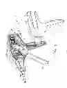 Fig. 07 - Surgical device with tandem fasteners