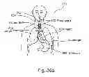 Fig. 63 - System and method for radioactive emission measurement