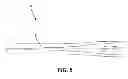 Fig. 06 - ERGONOMIC TROLLEY HANDLE