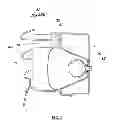 Fig. 05 - External airbag apparatus