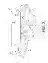Fig. 04 - UNDERCARRIAGE TRACK LINK