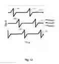 Fig. 14 - Method for controlling an inertial drive