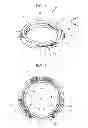Fig. 02 - Vibration-type driving device