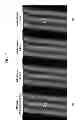 Fig. 08 - Liquid crystal display comprising first and second electrodes wherein the second electrode comprises a plurality of branch electrodes overlapping the first electrode