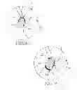 Fig. 06 - Optic neuropathy detection with three-dimensional optical coherence tomography