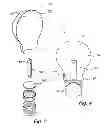 Fig. 04 - Illumination device with carrier and envelope