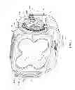 Fig. 02 - Mounting apparatus for adjustably positioning a lighting device