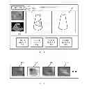 Fig. 04 - MEDICAL IMAGING SYSTEM AND METHOD FOR PROVIDING IMAGING ASSITANCE