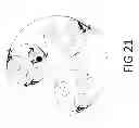 Fig. 24 - Overlay network topology system and a network node device therefor