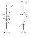 Fig. 64 - System and method for annealing nuclear fission reactor materials