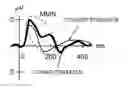 Fig. 01 - Speech-sound distinguishing ability determination apparatus, speech-sound distinguishing ability determination system, hearing aid gain determination apparatus, speech-sound distinguishing ability determination method, and program thereof