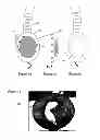 Fig. 04 - Listening device and accompanying signal processing method