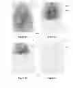 Fig. 15 - Fake fingerprint detection system