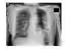 Fig. 01 - Method and apparatus for enhancing medical images
