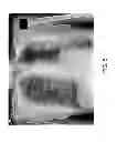 Fig. 06 - Method and apparatus for enhancing medical images