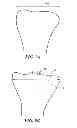Fig. 07 - Methods for determining meniscal size and shape and for devising treatment