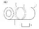 Fig. 02 - METHOD AND HYBRID IMAGING MODALITY FOR PRODUCING A COMBINATION IMAGE