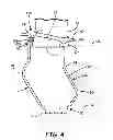 Fig. 05 - Turbine nozzle baffle