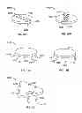 Fig. 06 - DEVICES AND METHODS FOR TREATING PAIN ASSOCIATED WITH TONSILLECTOMIES