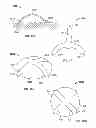 Fig. 09 - DEVICES AND METHODS FOR TREATING PAIN ASSOCIATED WITH TONSILLECTOMIES