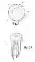 Fig. 02 - DENTAL COMPOSITIONS CONTAINING SILICA MICROBEADS
