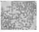 Fig. 01 - SPHERICAL PARTICLES OF CLOPIDOGREL BISULFATE, PHARMACEUTICAL COMPOSITION COMPRISING THE SAME, AND PREPARATION METHOD THEREOF
