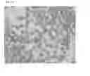 Fig. 02 - SPHERICAL PARTICLES OF CLOPIDOGREL BISULFATE, PHARMACEUTICAL COMPOSITION COMPRISING THE SAME, AND PREPARATION METHOD THEREOF