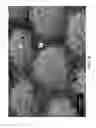 Fig. 09 - Fluid-Entangled Laminate Webs Having Hollow Projections and a Process and Apparatus for Making the Same