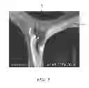 Fig. 02 - FOAM-LIKE MATERIALS AND METHODS FOR PRODUCING SAME
