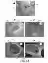 Fig. 11 - FOAM-LIKE MATERIALS AND METHODS FOR PRODUCING SAME