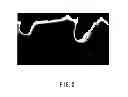 Fig. 03 - Anode for secondary battery, secondary battery, and method of manufacturing anode for secondary battery