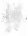 Fig. 23 - Method and apparatus for measuring a location and orientation of a plurality of implants