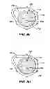 Fig. 11 - Oral care device
