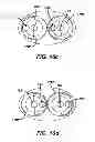 Fig. 13 - Oral care device